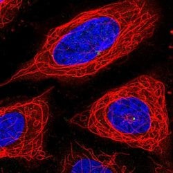 Invitrogen ADPGK Polyclonal Antibody 100 &mu;L; Unconjugated:Antibodies,