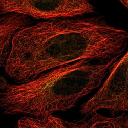 Invitrogen STK32B Polyclonal Antibody 100 &mu;L; Unconjugated:Antibodies,