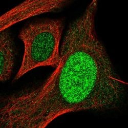 Invitrogen SP110 Polyclonal Antibody 100 &mu;L; Unconjugated:Antibodies,