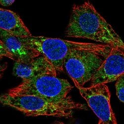 Invitrogen MIP-1 delta Polyclonal Antibody 100 &mu;L; Unconjugated:Antibodies,