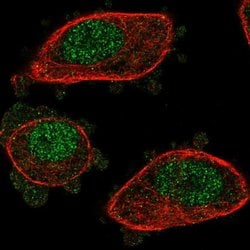 Invitrogen NUDT2 Polyclonal Antibody 100 &mu;L; Unconjugated:Antibodies,