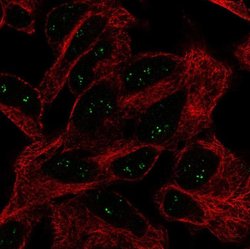 Invitrogen eIF4E3 Polyclonal Antibody 100 &mu;L; Unconjugated:Antibodies,