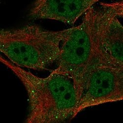 Fbxo16 Polyclonal Antibody:Antibodies, Polyclonal