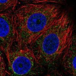 Invitrogen BDH1 Polyclonal Antibody 100 &mu;L; Unconjugated:Antibodies,