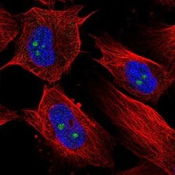 Invitrogen RBM19 Polyclonal Antibody 100 &mu;L; Unconjugated:Antibodies,