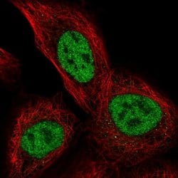 Invitrogen TSSC4 Polyclonal Antibody 100 &mu;L; Unconjugated:Antibodies,