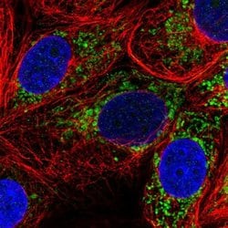 Invitrogen Pyruvate Carboxylase Polyclonal Antibody 100 &mu;L; Unconjugated:Antibodies,