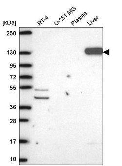 Invitrogen Pyruvate Carboxylase Polyclonal Antibody 100 &mu;L; Unconjugated:Antibodies,