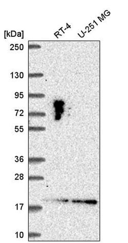 Invitrogen LLPH Polyclonal Antibody 100 &mu;L; Unconjugated:Antibodies,
