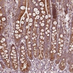 Invitrogen SEL1L3 Polyclonal Antibody 100 &mu;L | Buy Online | Invitrogen&trade; | Fisher Scientific