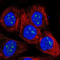 Invitrogen RP11-849H4.2 Polyclonal Antibody 100 &mu;L; Unconjugated:Antibodies,