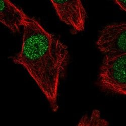 Invitrogen POLM Polyclonal Antibody 100 &mu;L; Unconjugated:Antibodies,