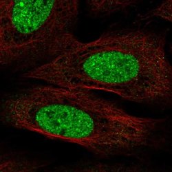Invitrogen CPEB3 Polyclonal Antibody 100 &mu;L; Unconjugated:Antibodies,