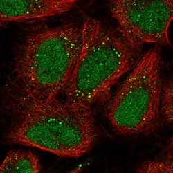 Invitrogen EXOC6 Polyclonal Antibody 100 &mu;L; Unconjugated:Antibodies,