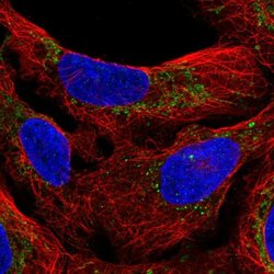 Invitrogen M1AP Polyclonal Antibody 100 &mu;L; Unconjugated:Antibodies,