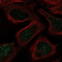 Invitrogen GSS Polyclonal Antibody 100 &mu;L; Unconjugated:Antibodies,