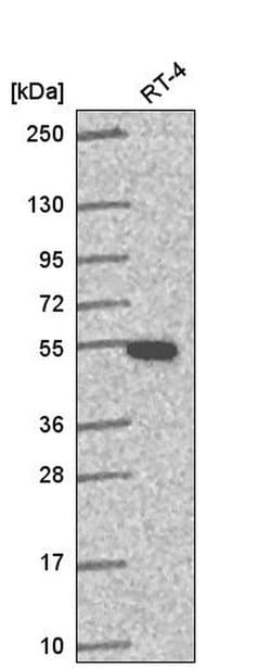 Invitrogen GSS Polyclonal Antibody 100 &mu;L; Unconjugated:Antibodies,
