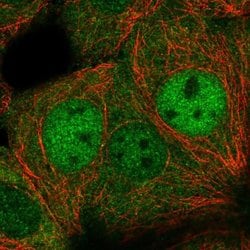 Invitrogen DIP2C Polyclonal Antibody 100 &mu;L; Unconjugated:Antibodies,