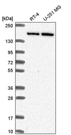 Invitrogen DIP2C Polyclonal Antibody 100 &mu;L; Unconjugated:Antibodies,