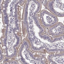 Invitrogen GRK1 Polyclonal Antibody 100 &mu;L | Buy Online | Invitrogen&trade; | Fisher Scientific