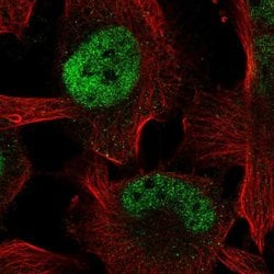 Invitrogen ZBTB38 Polyclonal Antibody 100 &mu;L; Unconjugated:Antibodies,