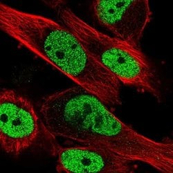 Invitrogen HNRNPA0 Polyclonal Antibody 100 &mu;L; Unconjugated:Antibodies,