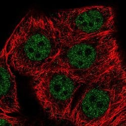 Invitrogen SETD1B Polyclonal Antibody 100 &mu;L; Unconjugated:Antibodies,