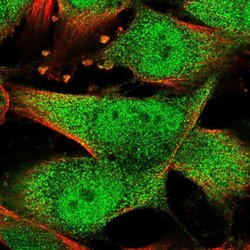 Invitrogen PPP1R2 Polyclonal Antibody 100 &mu;L; Unconjugated:Antibodies,