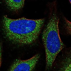 Invitrogen RNF23 Polyclonal Antibody 100 &mu;L; Unconjugated:Antibodies,