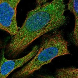 Invitrogen C14orf28 Polyclonal Antibody 100 &mu;L; Unconjugated:Antibodies,