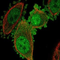 Invitrogen IMUP Polyclonal Antibody 100 &mu;L | Buy Online | Invitrogen&trade; | Fisher Scientific