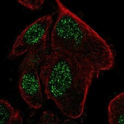 Invitrogen RPP25L Polyclonal Antibody 100 &mu;L; Unconjugated:Antibodies,