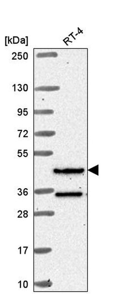 Invitrogen RFX8 Polyclonal Antibody 100 &mu;L | Buy Online | Invitrogen&trade; | Fisher Scientific