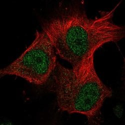Invitrogen METT10D Polyclonal Antibody 100 &mu;L; Unconjugated:Antibodies,