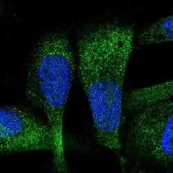 Invitrogen ZC3H7A Polyclonal Antibody 100 &mu;L; Unconjugated:Antibodies,