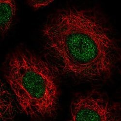 Invitrogen C16orf57 Polyclonal Antibody 100 &mu;L; Unconjugated:Antibodies,
