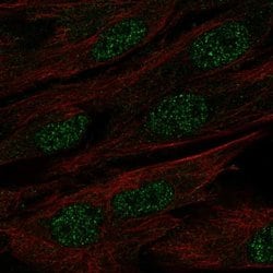 Invitrogen MAB21L1 Polyclonal Antibody 100 &mu;L; Unconjugated:Antibodies,