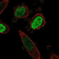 Invitrogen ONECUT3 Polyclonal Antibody 100 &mu;L; Unconjugated:Antibodies,