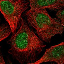Invitrogen C5orf28 Polyclonal Antibody 100 &mu;L; Unconjugated:Antibodies,
