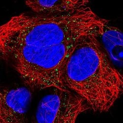 CNNM2 Polyclonal Antibody:Antibodies, Polyclonal