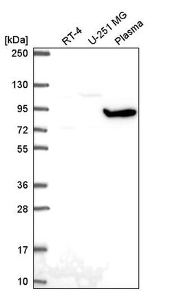 Invitrogen GNL2 Polyclonal Antibody 100 &mu;L | Buy Online | Invitrogen&trade; | Fisher Scientific