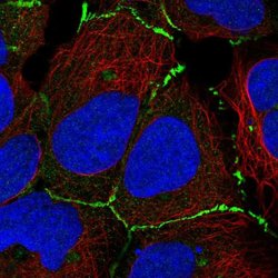 Invitrogen DJC18 Polyclonal Antibody 100 &mu;L; Unconjugated:Antibodies,
