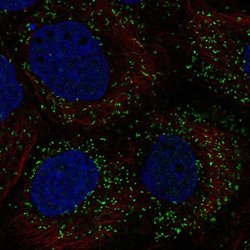 Invitrogen PPP1R11 Polyclonal Antibody 100 &mu;L; Unconjugated:Antibodies,