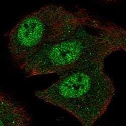 Invitrogen SMOX Polyclonal Antibody 100 &mu;L; Unconjugated:Antibodies,