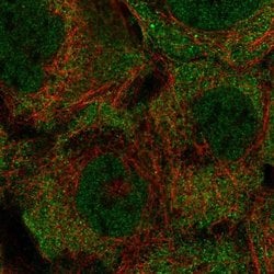 Invitrogen KRTCAP3 Polyclonal Antibody 100 &mu;L; Unconjugated:Antibodies,
