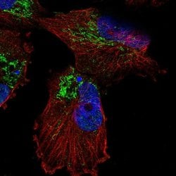 Invitrogen SLC25A14 Polyclonal Antibody 100 &mu;L | Buy Online | Invitrogen&trade; | Fisher Scientific