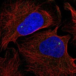 Invitrogen NOD4 Polyclonal Antibody 100 &mu;L; Unconjugated:Antibodies,