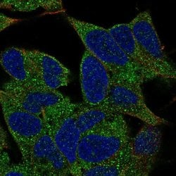 TMEM145 Polyclonal Antibody:Antibodies, Polyclonal