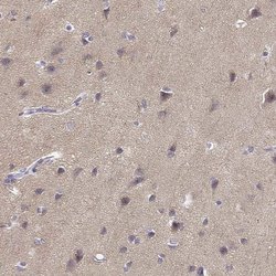 TMEM145 Polyclonal Antibody:Antibodies, Polyclonal