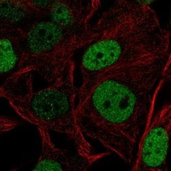 Invitrogen SOX5 Polyclonal Antibody 100 &mu;L; Unconjugated:Antibodies,